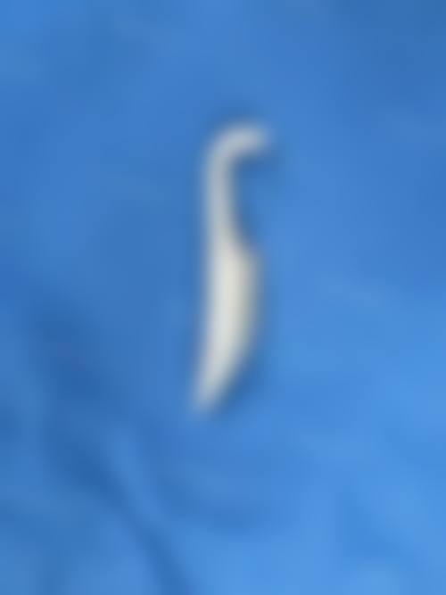 总结