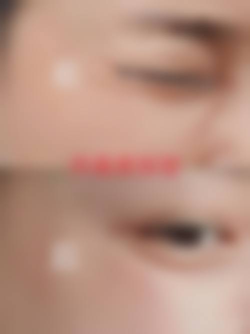 重庆艺高名品整形美容医院常见问题FAQ