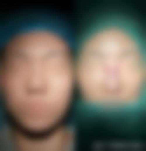 韩国Yumastem皮肤医院怎么预约?