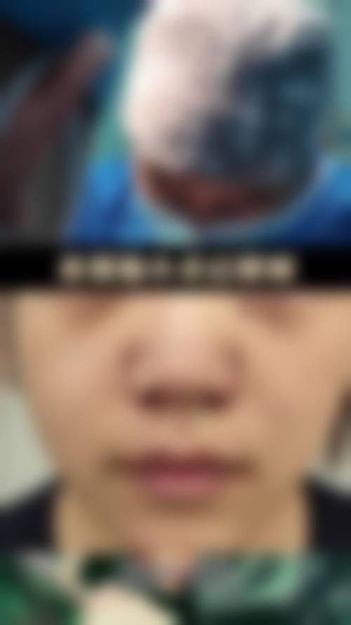 总结