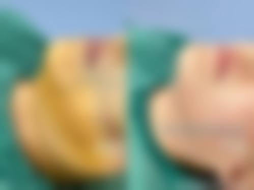 昭通爱丽诺美容整形常见问题FAQ