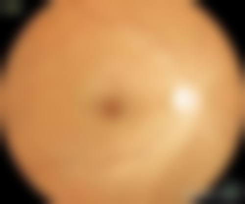 如何进行预约挂号?