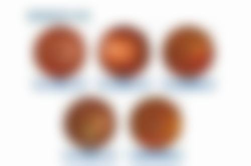 内蒙古医 科 大学附属医院眼科还有哪些优势项目?