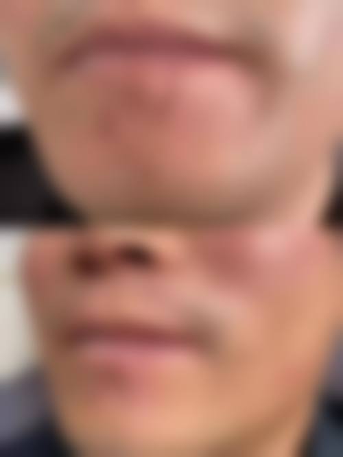 张孝乘医生掌握精细化的临床诊疗技术