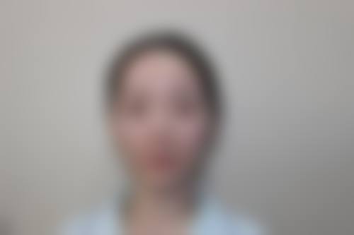 四川绵阳韩美整形常见问题FAQ
