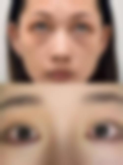 梅州诺丽医疗美容常见问题FAQ