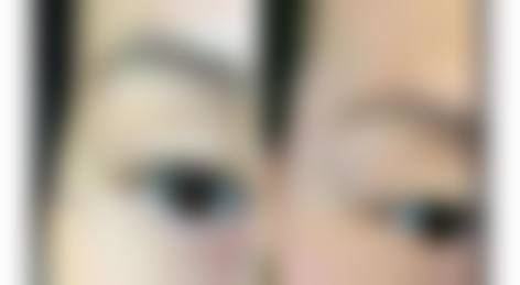 东莞美极医疗美容整形门诊部怎么预约?