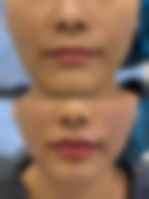 北京娇妍晟妍艾整形医院怎么预约?