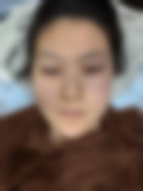 东莞美极医疗美容整形门诊部擅长项目