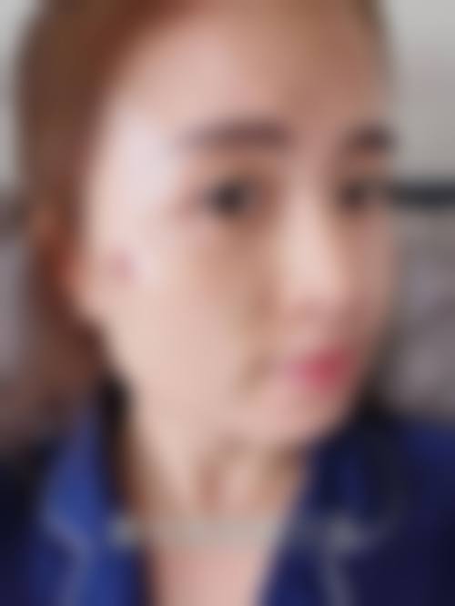 2026襄阳市中 心医院整形美容科价格表(仅供参考)