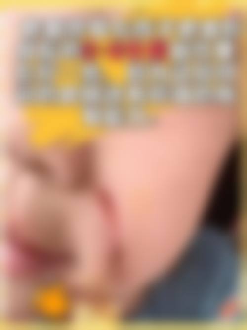 关于烧伤整形就医的高频问答
