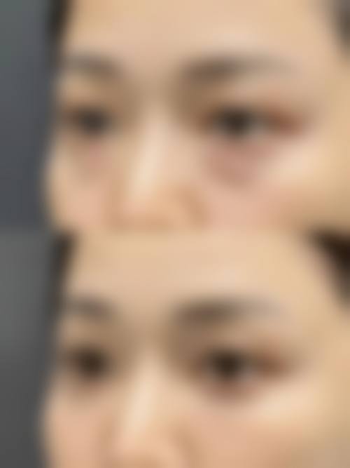 2026云南昆明茜迪兰医美价格表(仅供参考)