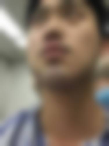 陕西西安沐森植发擅长项目