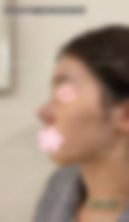 宁波花妍素整形医院怎么预约?