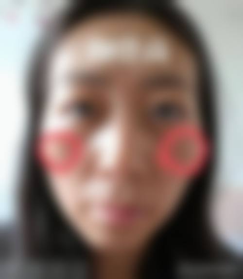 2026宁波花妍素整形医院价格表(仅供参考)