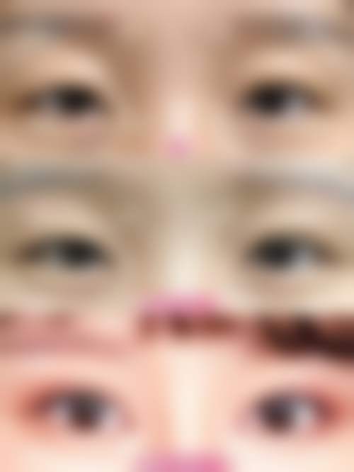 高频就医快问快答
