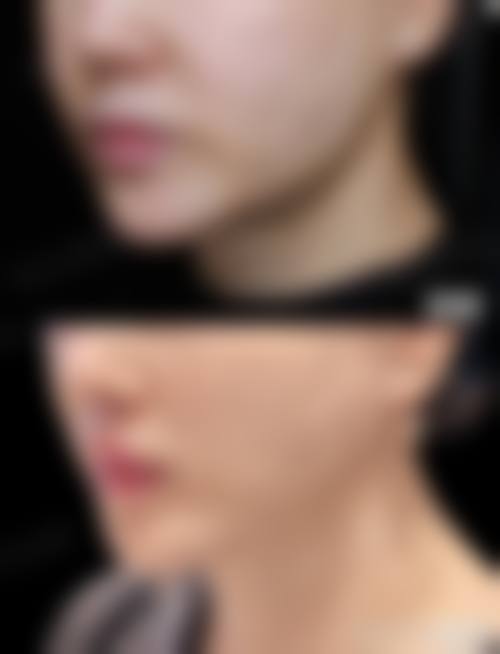 真实患者口碑评价参考