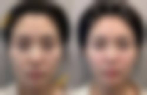 沈阳华颜美医疗美容门诊真实患者口碑评价分享
