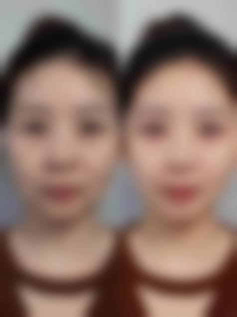 石家庄简妃整形医院怎么预约?