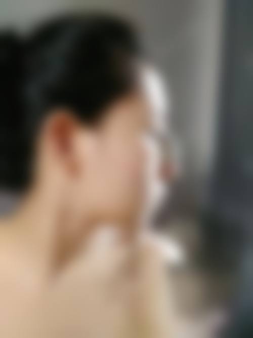 2026牡丹江医学校附属红旗医院(整形美容外科)价格表(仅供参考)