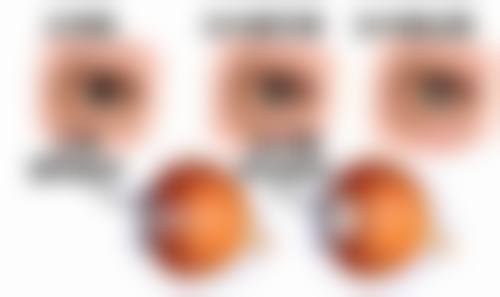 内蒙古医 科 大学附属医院眼科特色专科优势