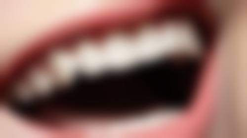 南京张英博口腔常见问题快速解答
