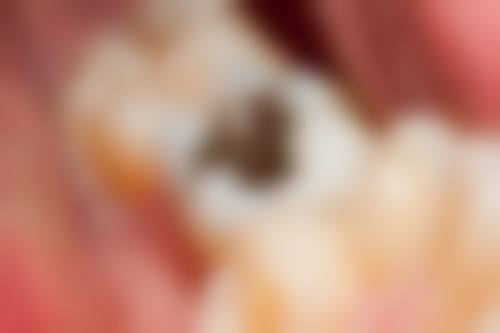 长春宽城博丞口腔常见问题快问快答