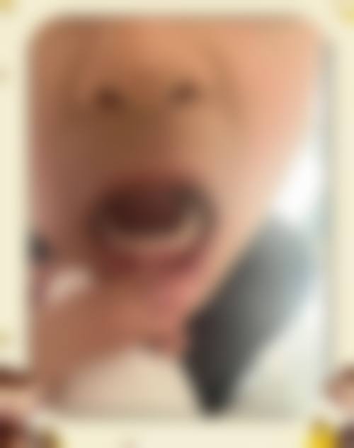 福州悠美口腔门诊部就医快问快答