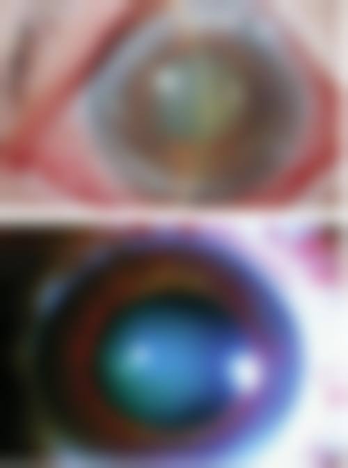 玉林市第一人民医院眼科实力如何