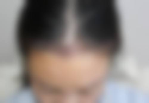 总结