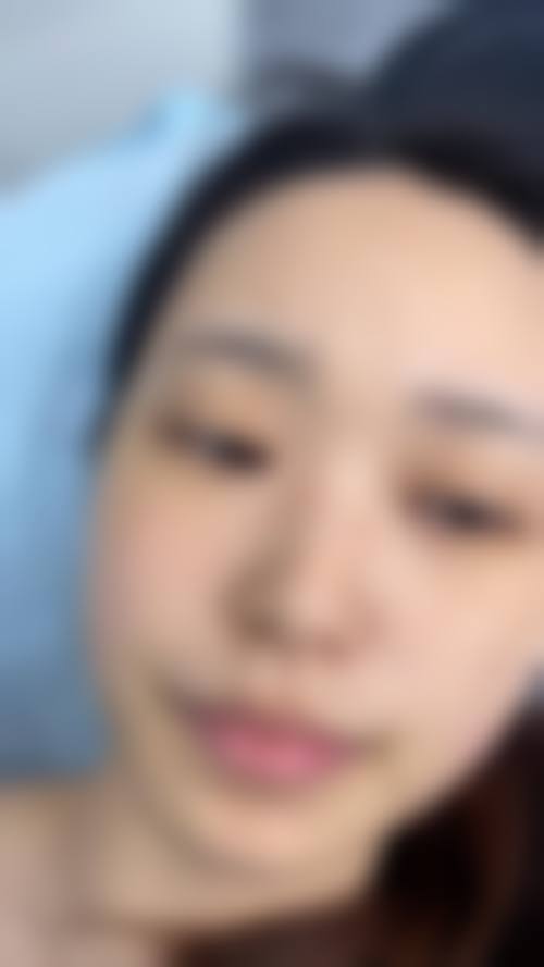 沈阳黄岚医疗整形美容诊所常见问题FAQ