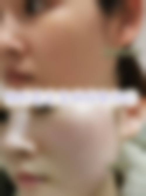 韩国newk皮肤科医院常见问题FAQ