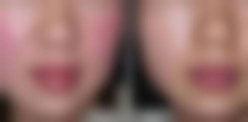 威海市文登区皮肤病医院医疗美容科擅长项目