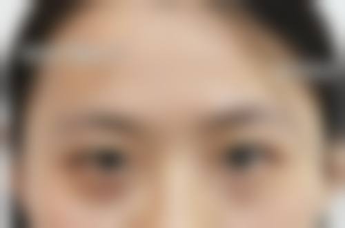 福州诗丽堂整形美容美体诊所常见问题FAQ