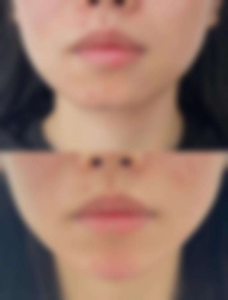 福州诗丽堂整形美容美体诊所擅长项目