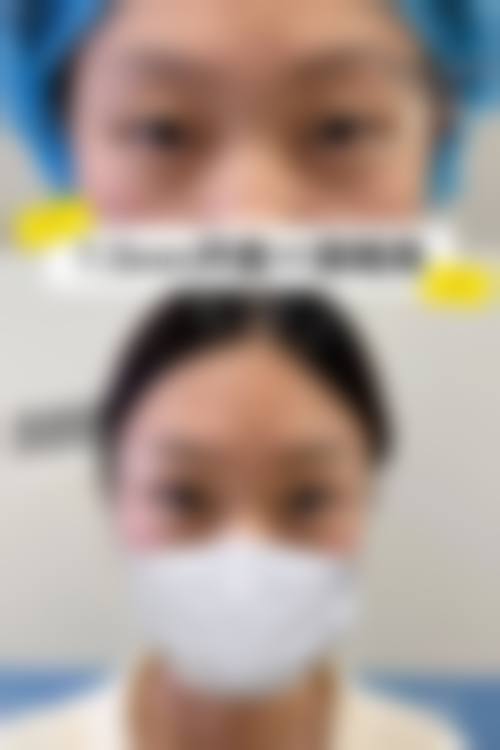 云南昭通爱丽诺美容整形常见问题FAQ