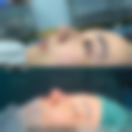 李祥仟医生核心技术实力与差异化优势