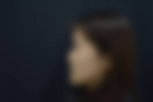 抚州求美整形医院常见问题FAQ