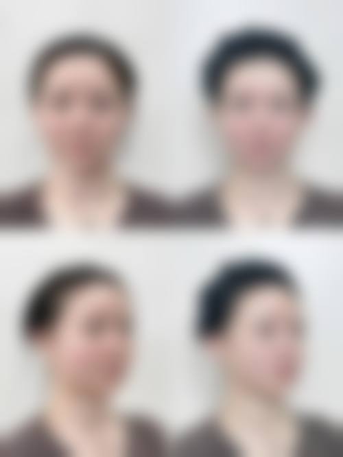 山西伊特雅整形美容门诊就医快问快答