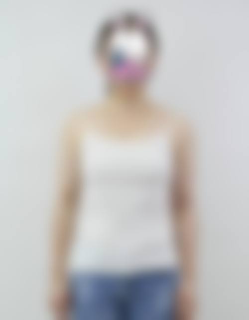 焦作惠仁医院医疗美容科常见问题FAQ