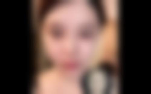 云南昭通爱丽诺美容整形擅长项目