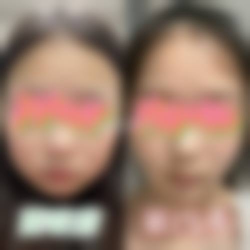 青岛市传染病医院（青岛市第六人民医院）整形科常见问题FAQ