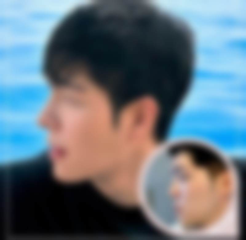 韩国优雅人整形外科朴哲佑怎么联系？下颌角/颧骨内推技术稳+术后自然不僵硬，官方电话获取攻略