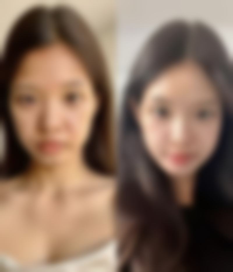 长沙博科整形医院擅长哪些整形项目