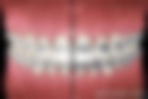 格登特舒克口腔诊所擅长哪些口腔项目