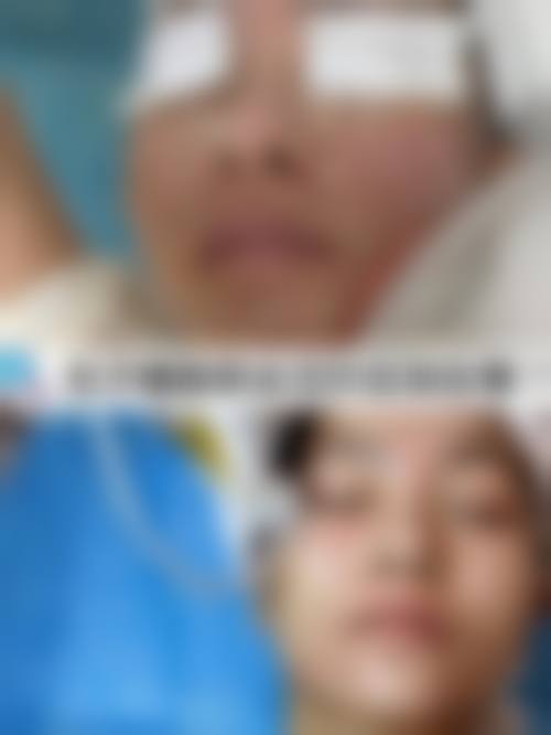 太原市人民医院医学美容科常见问题FAQ