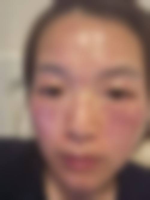 2026长春呈美医疗美容门诊部价格表（仅供参考）