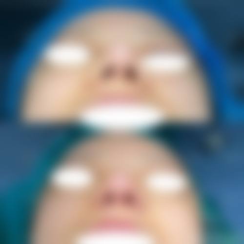 总结