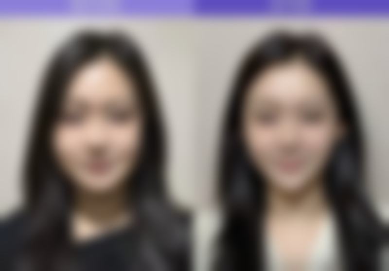 呼和浩特韩艺(哈日巴拉)医疗美容门诊部擅长项目有哪些