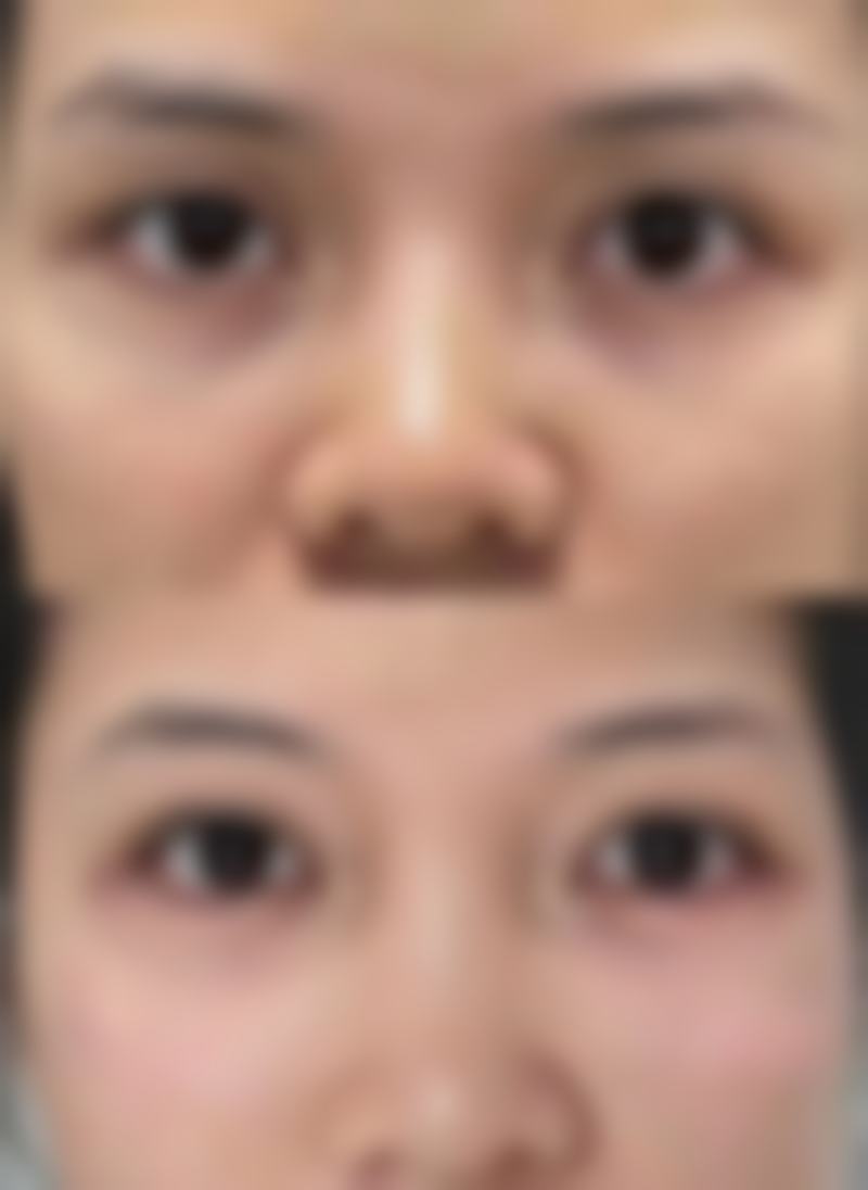 呼和浩特韩艺(哈日巴拉)医疗美容门诊部口碑评价分享